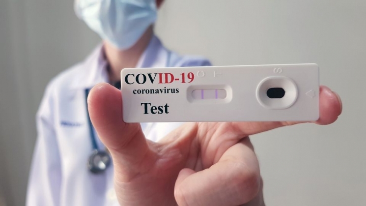 Acib realiza consulta com empresas associadas para distribuição de testes de Covid-19